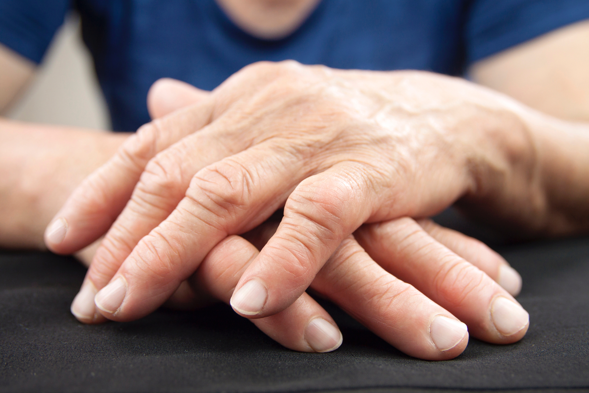 Revmatoidni artritis in vzroki za njegov nastanek